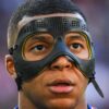 Kylian Mbappe terpaksa mendapatkan masker baru setelah muncul masalah dengan perlindungan hidung bintang Prancis itu